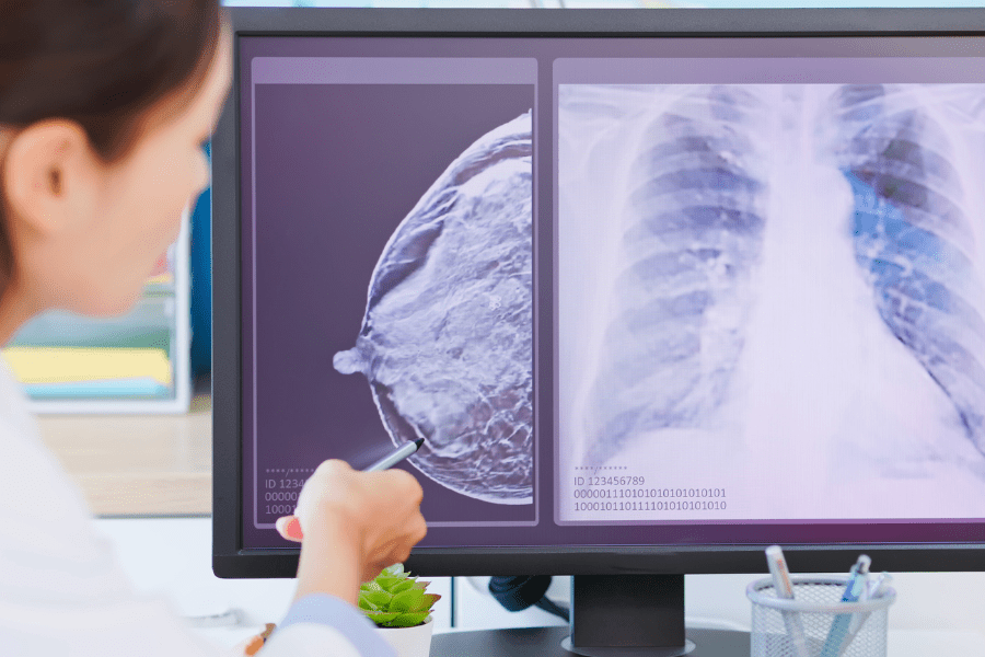 A provider examines a diagnostic image of a breast, looking for signs of breast cancer