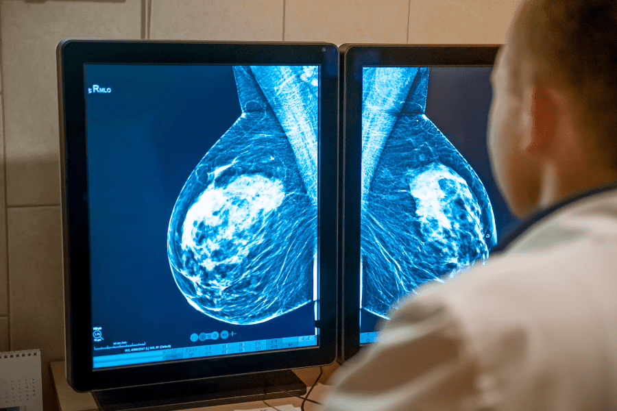 An imaging specialist examines a diagnostic image for breast cancer