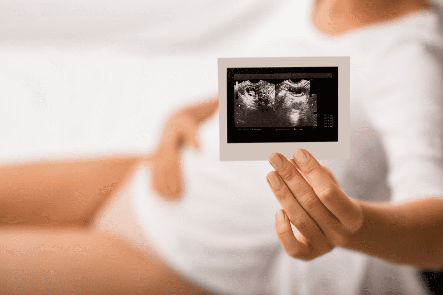 Woman holds up sonogram picture